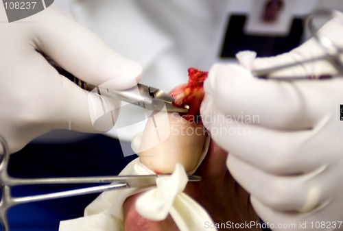 Image of Podiatric Surgery 1