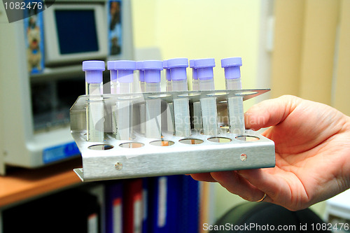 Image of hand holding test tubes