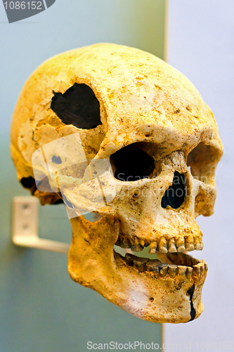 Image of Skull
