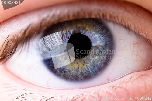 Image of Eye