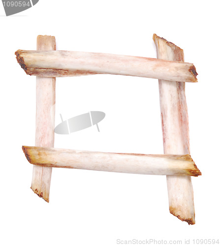 Image of bone frame