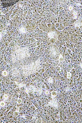 Image of Colon Cancer cells