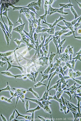 Image of Prostate Cancer cells