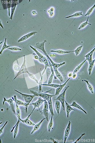 Image of Prostate Cancer cells