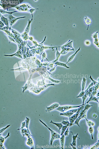 Image of Prostate Cancer cells