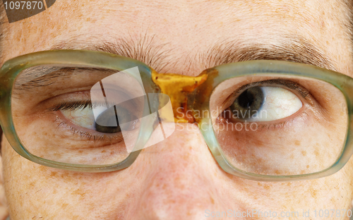Image of Cross-eyed person in old-fashioned spectacles