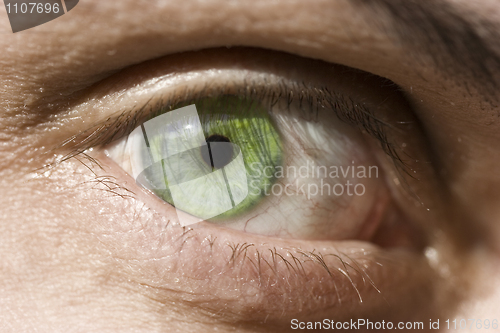 Image of eye 