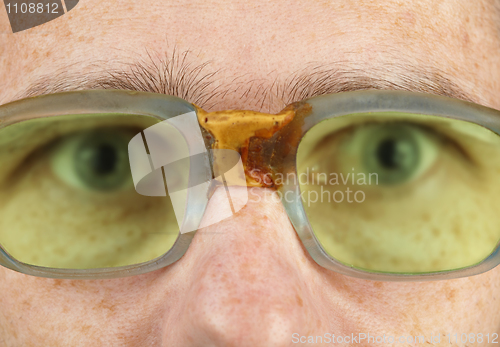 Image of Person in old bad spectacles with poor eyesight