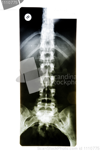 Image of X-ray