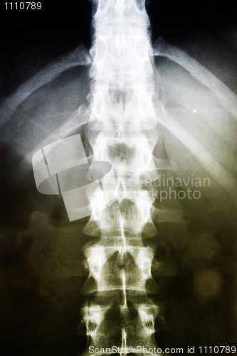 Image of X-ray