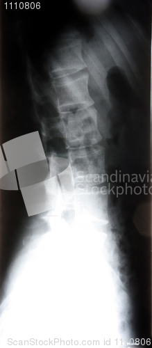 Image of X-ray