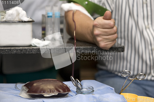 Image of blood donation