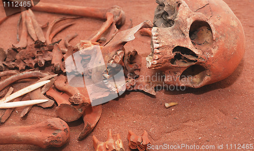 Image of Skeleton remains