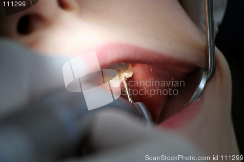 Image of Dentist at work