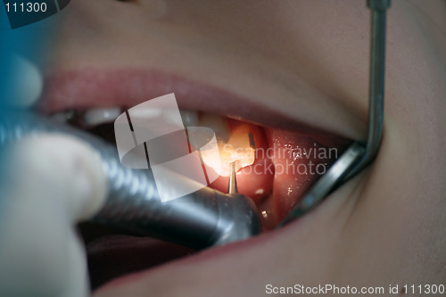 Image of Dentist at work