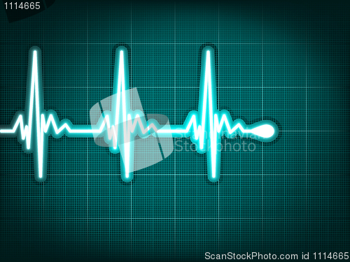 Image of Electrocardiogram track of human heart. EPS 8