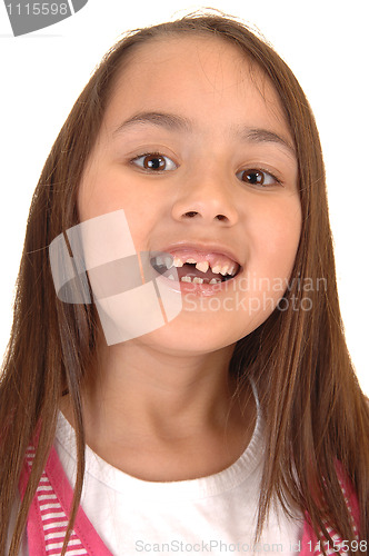 Image of Girl loosing her teeth.