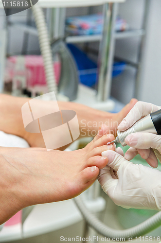 Image of pedicure