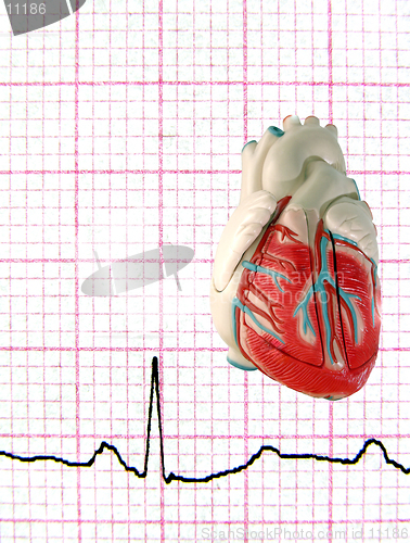 Image of Real EKG with Model Heart