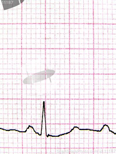 Image of Real EKG - macro of a real electrocardiograph