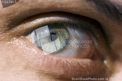 Image of Human eye