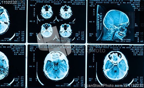 Image of many type of brain scans with dark background