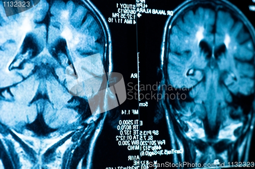 Image of Closeup of a CT scan with brain