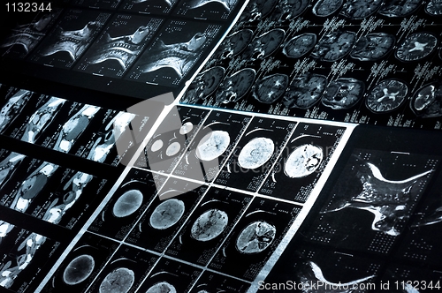 Image of Several CT computer tomography scan images of neck and brain