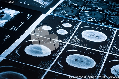 Image of Several CT computer tomography scan images of the brain