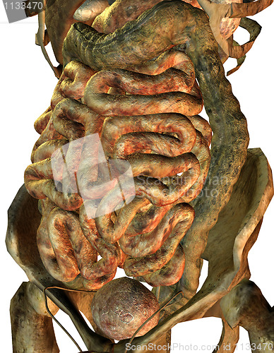 Image of ill male internal organs