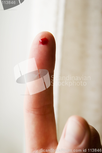 Image of Blood Prick