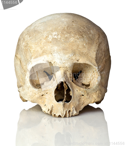Image of skull on white