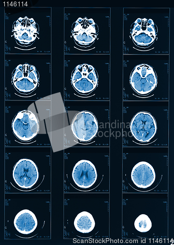 Image of X-ray computed tomography