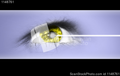 Image of eye laser operation