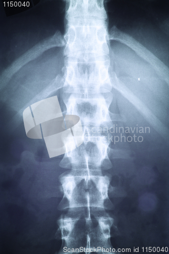 Image of X-ray