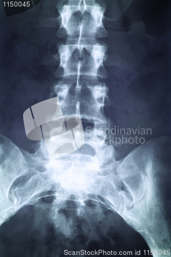 Image of X-ray