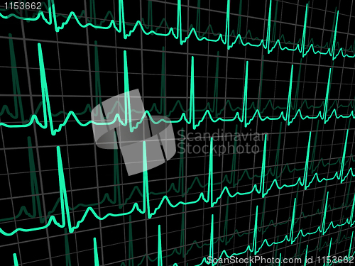 Image of ECG tracing monitor. EPS 8