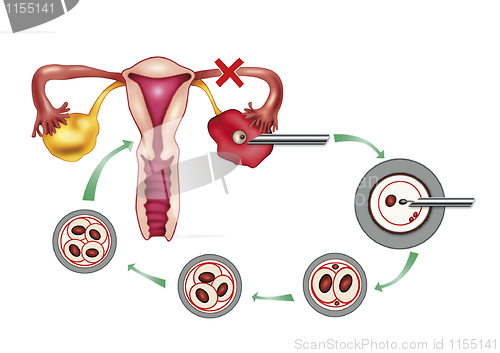 Image of artificial insemination