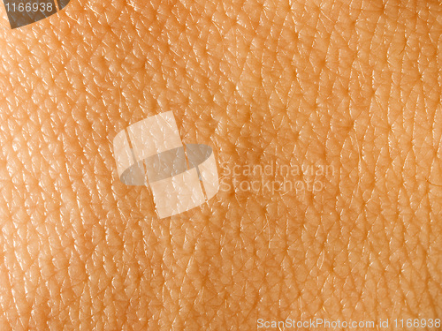 Image of Skin.