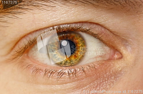 Image of eye closeup
