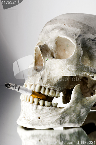 Image of Skull with burning cigarette in mouth
