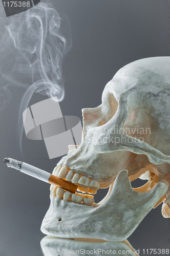 Image of Skull with burning cigarette in mouth