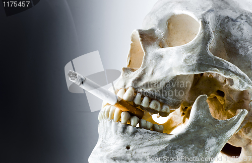 Image of Skull with burning cigarette in mouth