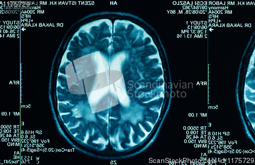 Image of sharp ct scan of the human brain