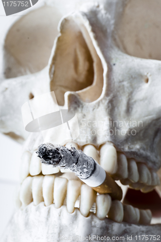 Image of Skull with burning cigarette in mouth