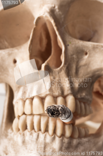 Image of human skull with burnt down cigarette