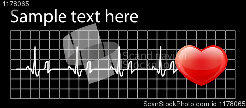 Image of Heart cardiogram