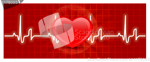 Image of Heart cardiogram