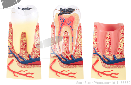 Image of Tooth anatomy