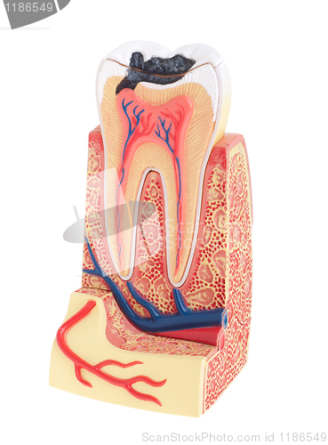 Image of Tooth anatomy